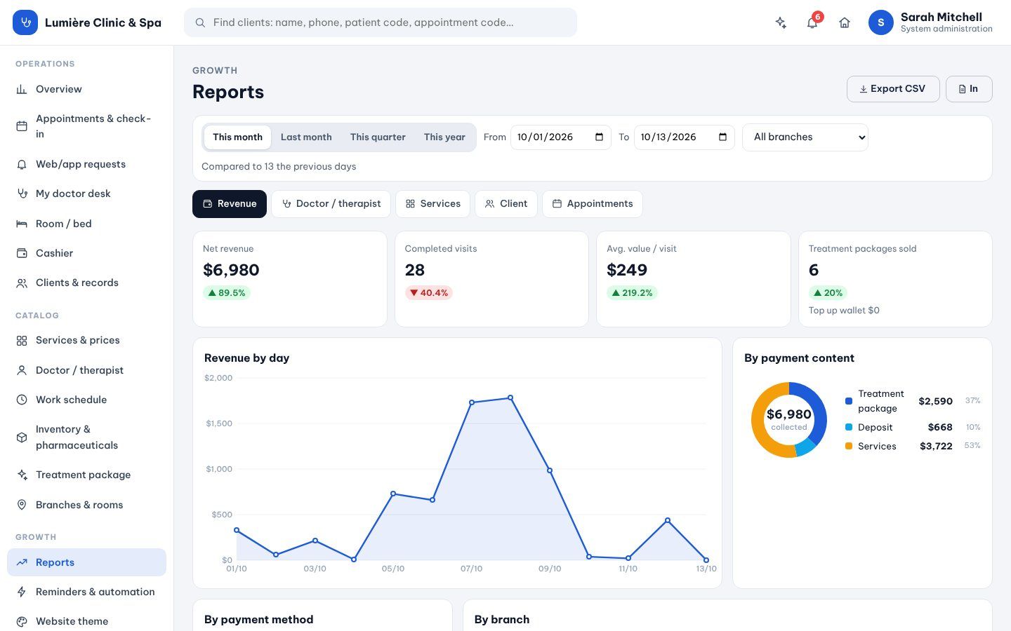 Services, packages, stock and revenue